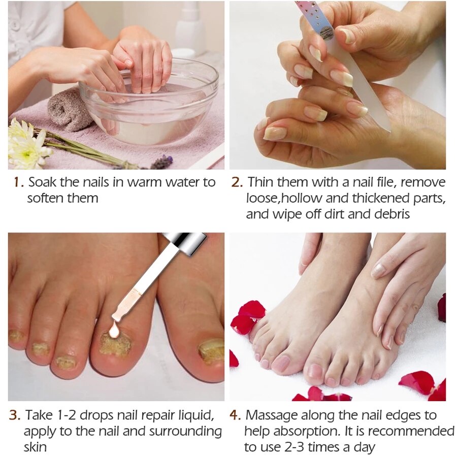 Nail Treatments