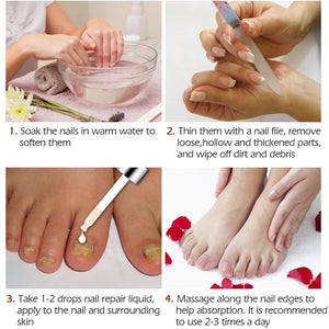 Nail Treatments